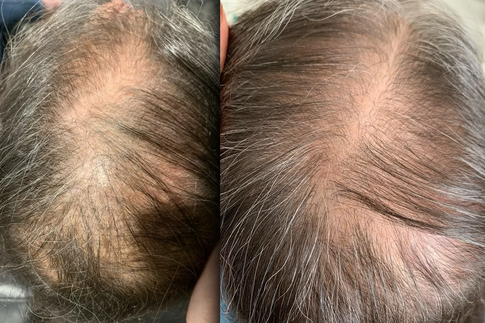 Hair Renewal